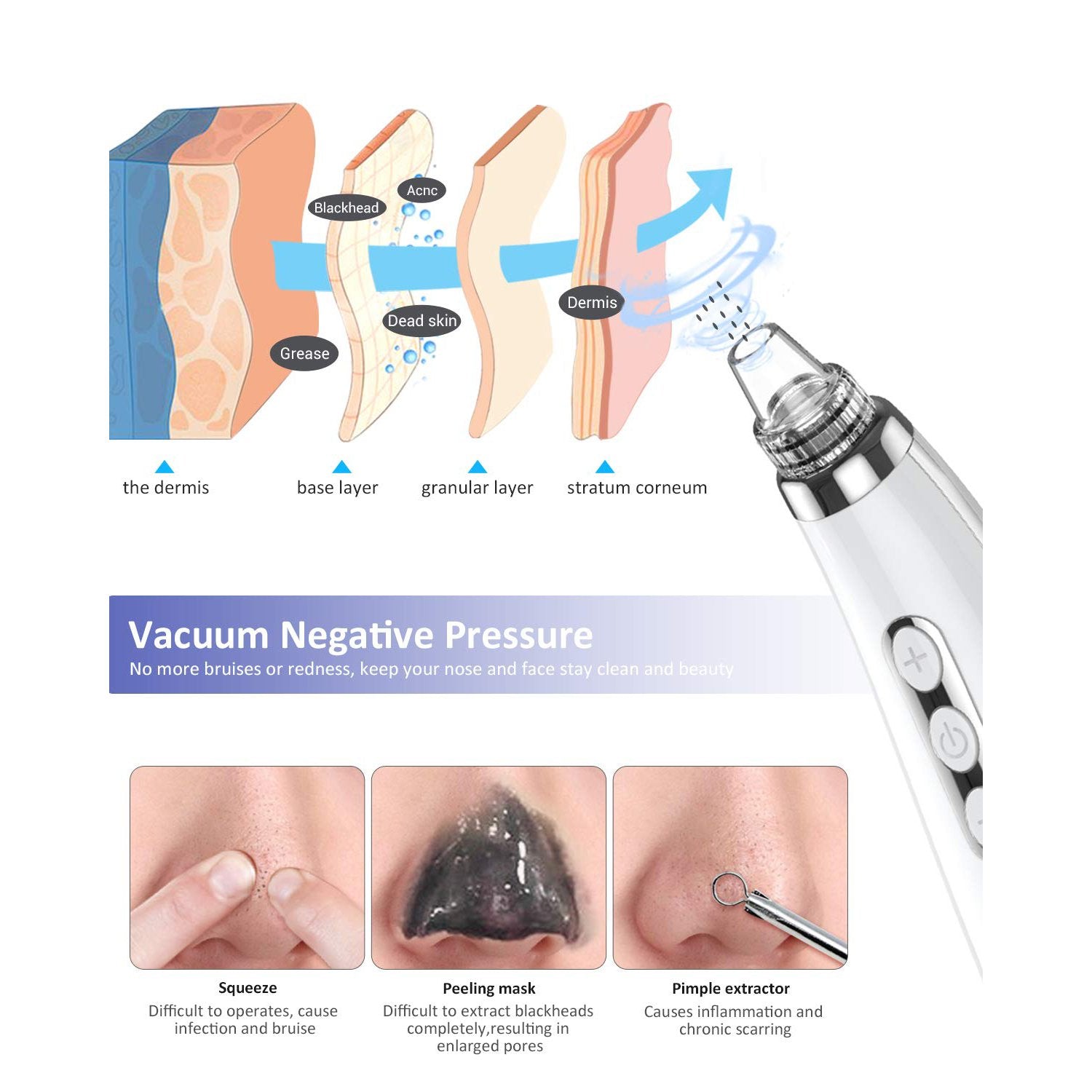 Blackhead Pore Vacuum Cleaner Remover Beauty & Personal Care - DailySale