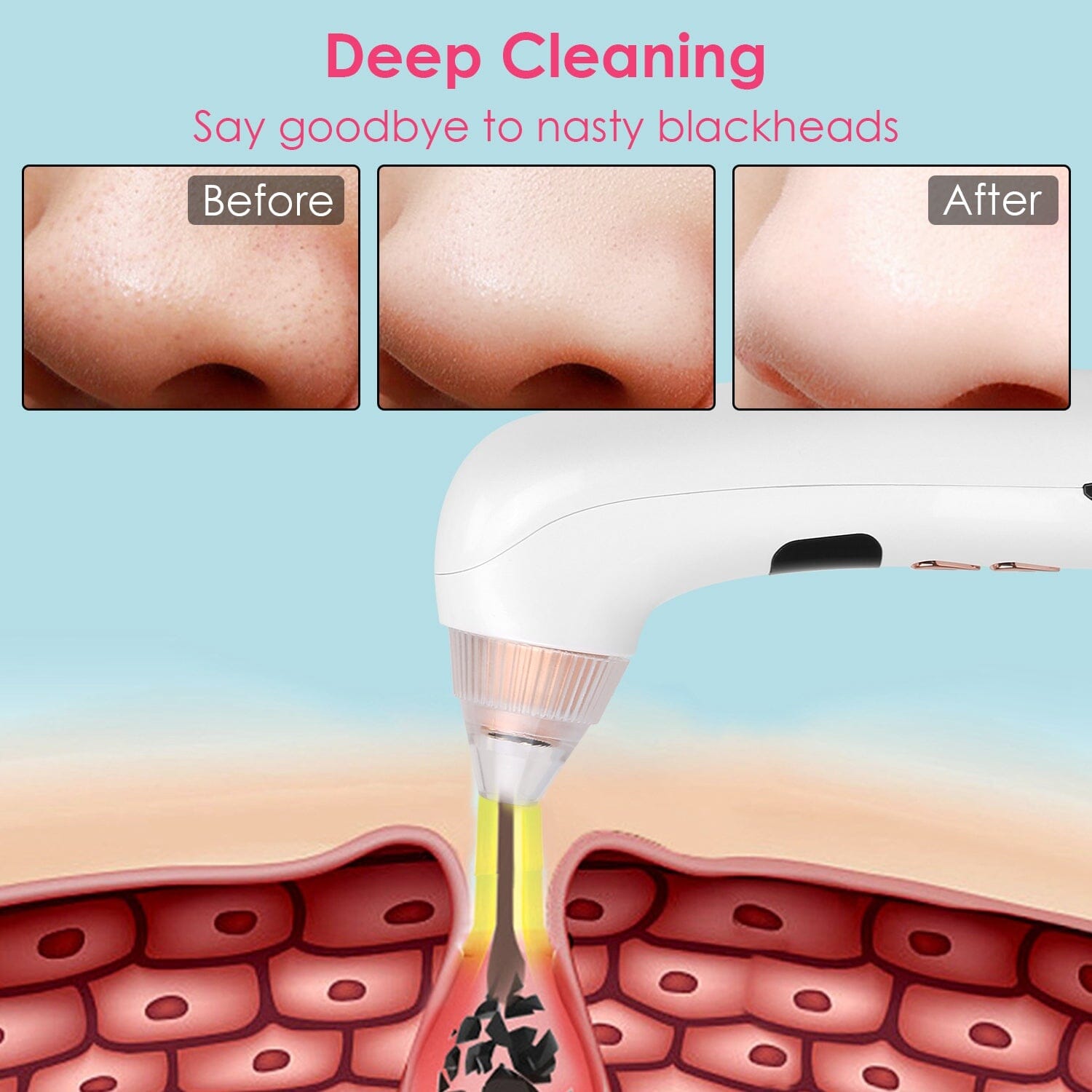 Blackhead Vacuum Remover Electric Blackhead Comedone Extractor Beauty & Personal Care - DailySale