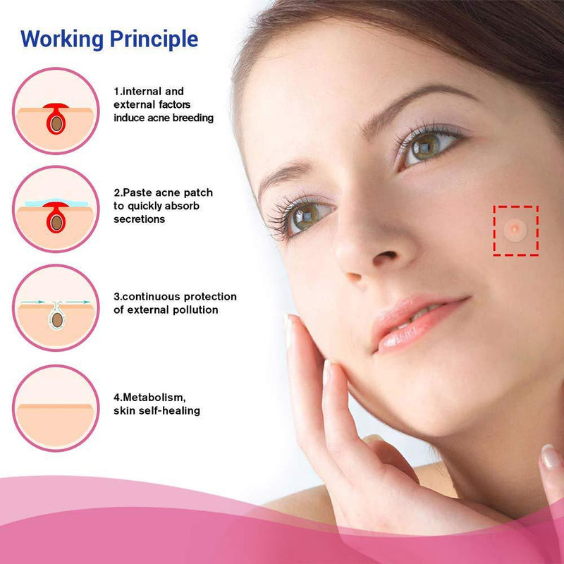 Blemish and Acne Treatment Skin Healing Spot Patches Beauty & Personal Care - DailySale