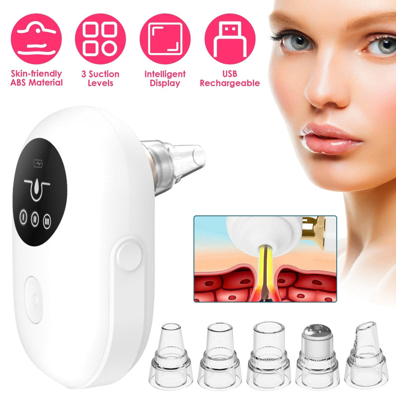 Electric Blackhead Comedone Extractor Tool Facial Pore Cleaner Beauty & Personal Care - DailySale