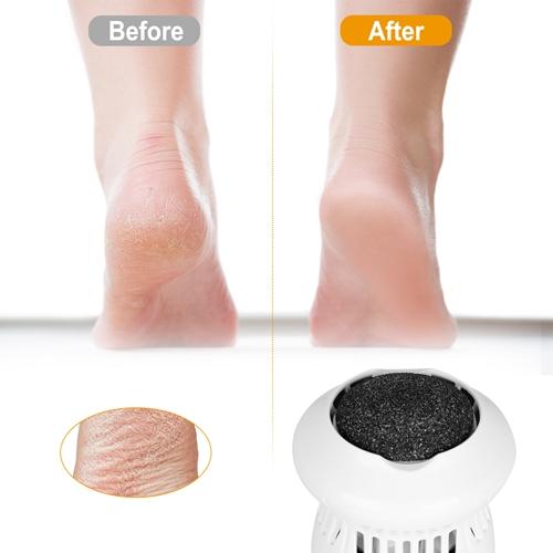 Electric Callus Grinder USB Rechargeable Beauty & Personal Care - DailySale