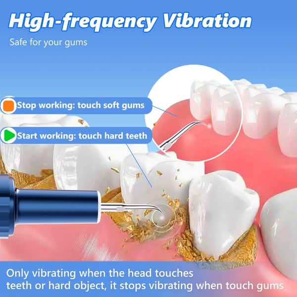Electric Plaque Remover for Teeth, Rechargeable Teeth Cleaning Kit with 4 Modes Beauty & Personal Care - DailySale