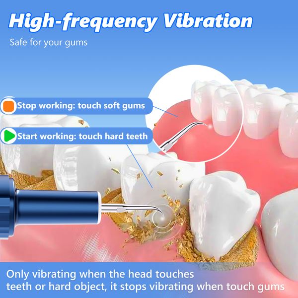 Electric Plaque Remover for Teeth, Rechargeable Teeth Cleaning Kit with 4 Modes Beauty & Personal Care - DailySale