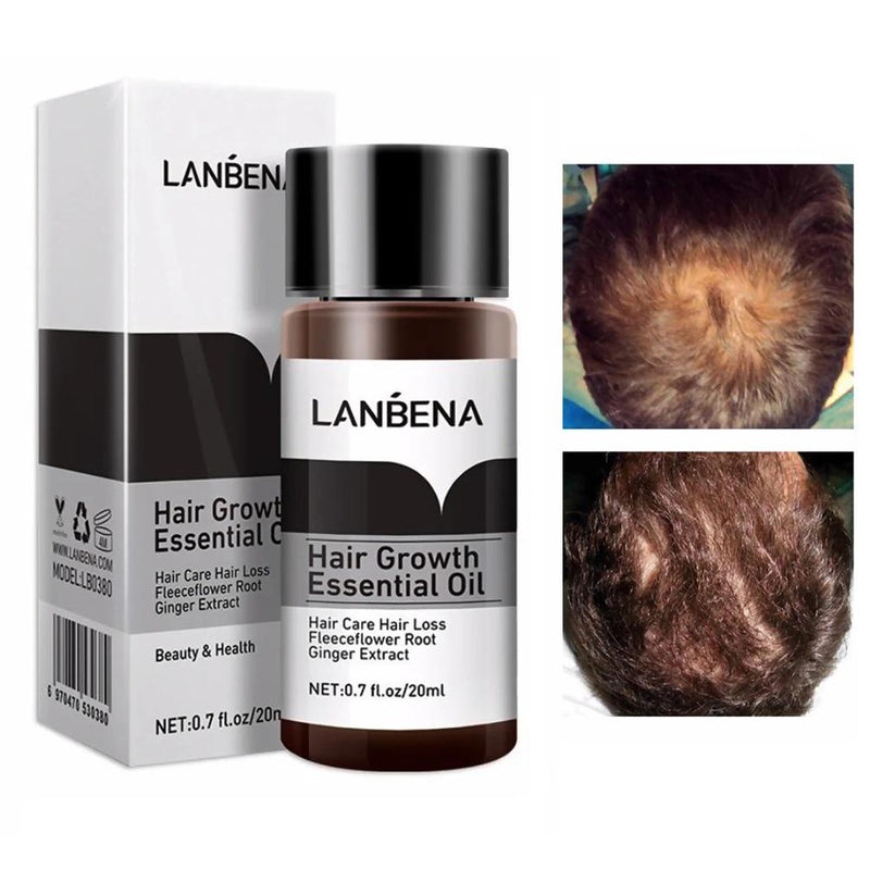 Essential Oil For Hair Growth And Hair Loss Treatment For Men And Women Beauty & Personal Care - DailySale