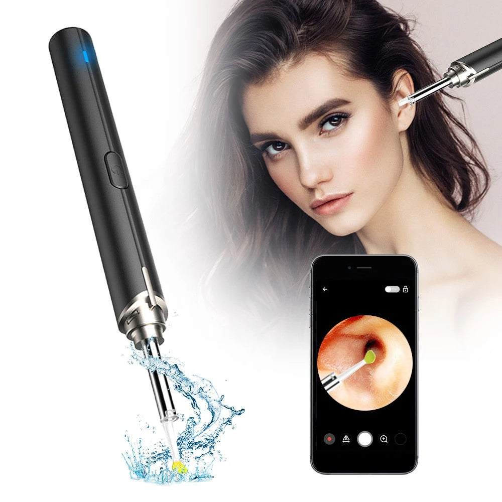 Intelligent Visual Ear Otoscope Inspection Tool Beauty & Personal Care - DailySale