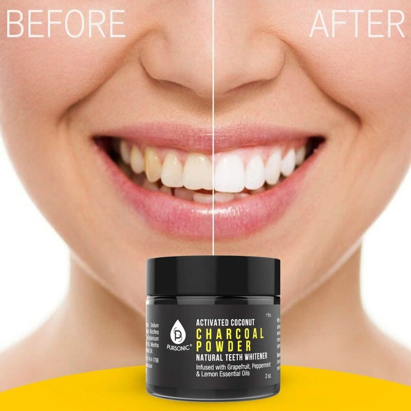 S520 Sonic Toothbrush - Accessories and Activated Coconut Charcoal Powder Beauty & Personal Care - DailySale
