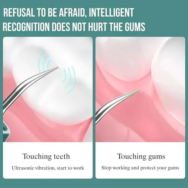 Visual Ultrasonic Teeth Cleaner Beauty & Personal Care - DailySale